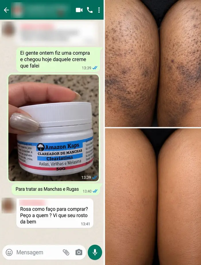 Conversa de cliente com a embalagem anterior do produto e fotos de resultado