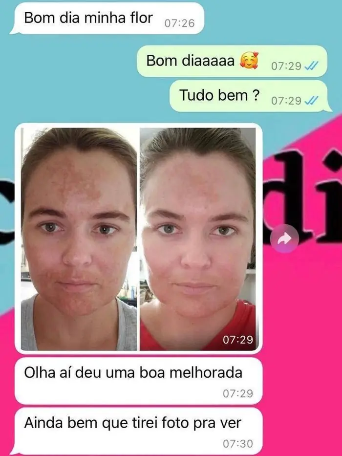 Conversa de cliente no WhatsApp com fotos de antes e depois