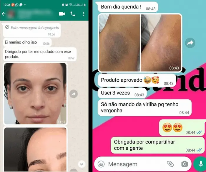 Conversas de clientes no WhatsApp com fotos de resultado